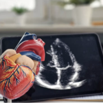 Private Echocardiogram UK